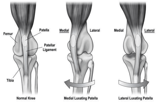 정상적인 무릎(왼쪽), 슬개골 내측 탈구(가운데), 슬개골 외측 탈구(오른쪽)