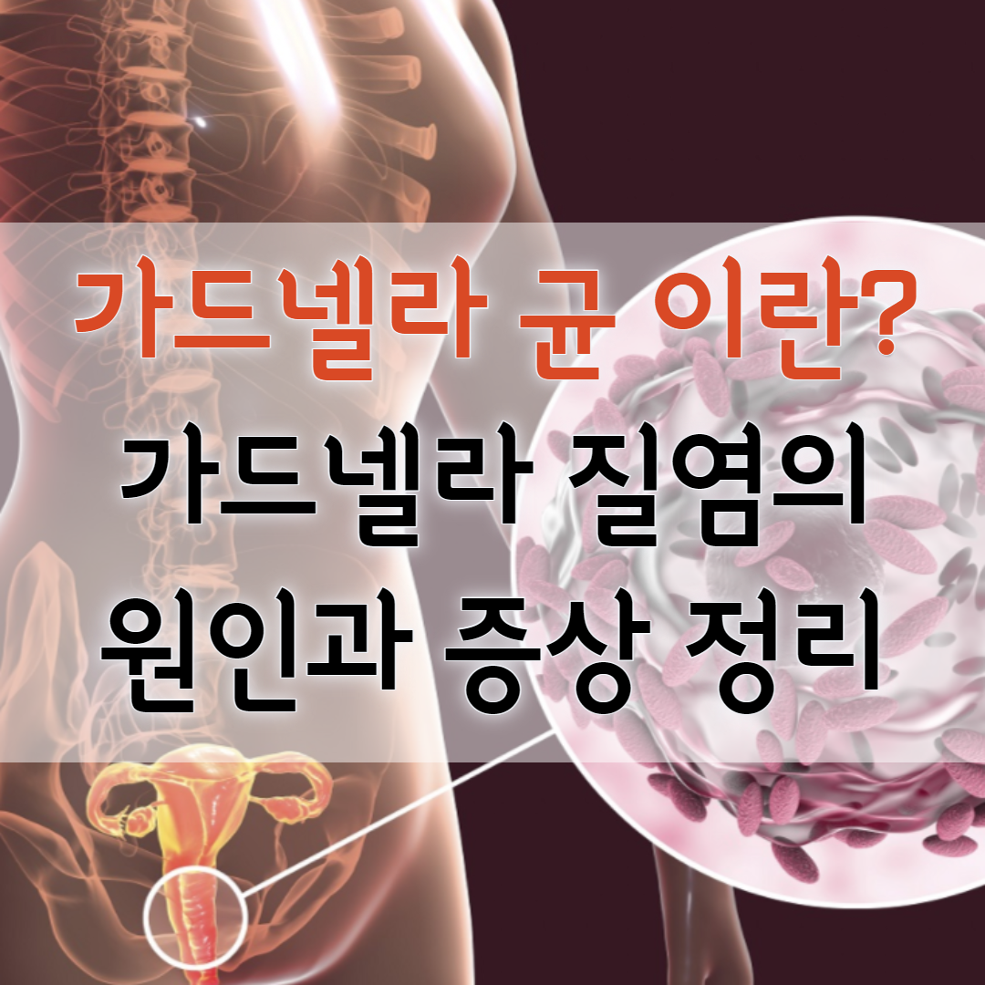 가드넬라균세균성질염증상(+성병) 2